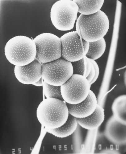 Avocado pollen grains attached to European honey bee hair